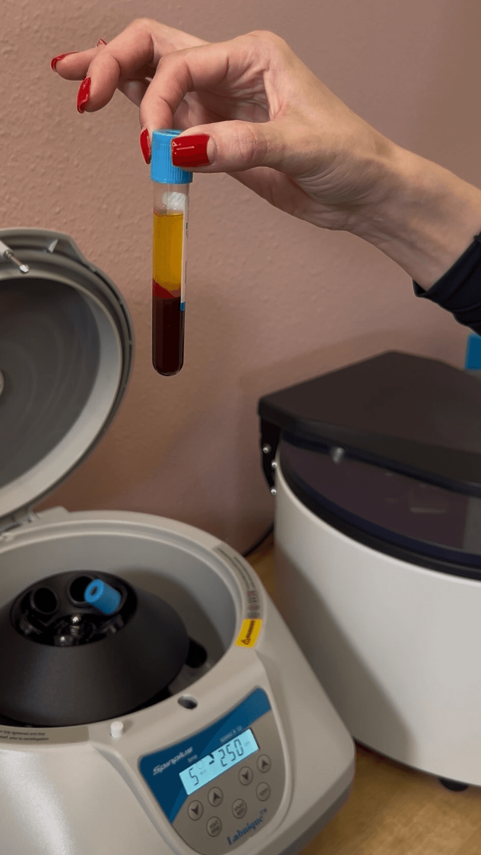 PRP centrifuge with platelet-rich plasma